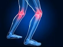 Joint Replacement Academy 2837 1 joint replacement academy physical therapy & performance